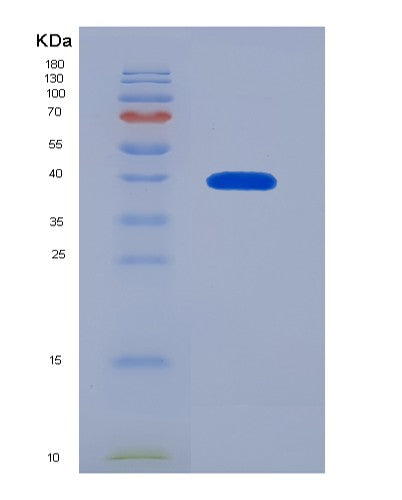 SDS-PAGE analysis of Human CCL1 (C-C Motif Chemokine 1) - Recombinant Protein, CATHuman CCL1 (C-C Motif Chemokine 1) - Recombinant Protein