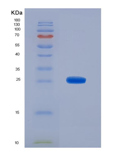 SDS-PAGE analysis of Human CALB2 (Calretinin) - Recombinant Protein, CAT# BLT-00389P, showing >85% purity under 15% SDS-PAGE (Reduced)Human CALB2 (Calretinin) - Recombinant Protein