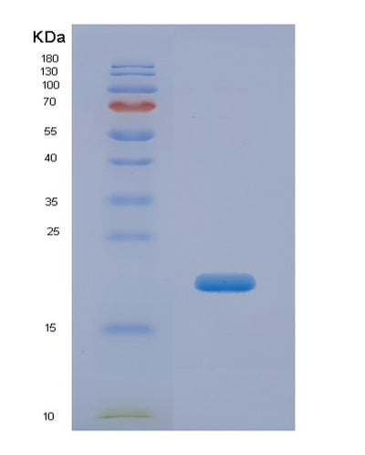 SDS-PAGE analysis of Human CPN2 (Carboxypeptidase N Subunit 2) - Recombinant Protein, CAT# BLT-00033P, showing >85% purity under 15% SDS-PAGE (Reduced)Human CPN2 (Carboxypeptidase N Subunit 2) - Recombinant Protein