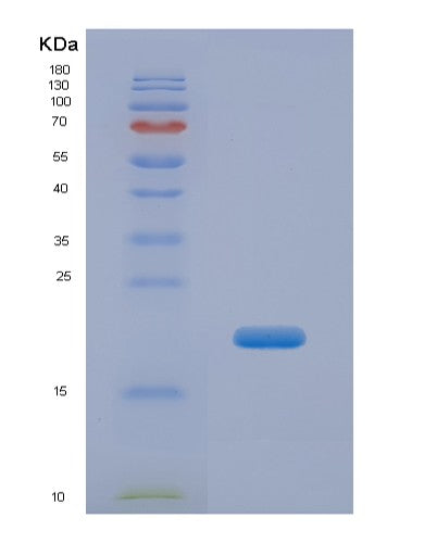SDS-PAGE analysis of Human CPN2 (Carboxypeptidase N Subunit 2) - Recombinant Protein, CATHuman CPN2 (Carboxypeptidase N Subunit 2) - Recombinant Protein