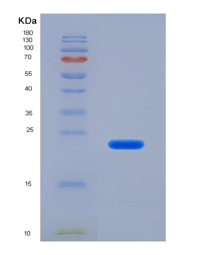 SDS-PAGE analysis of Human CFL1 (Cofilin-1) - Recombinant Protein, CATHuman CFL1 (Cofilin-1) - Recombinant Protein