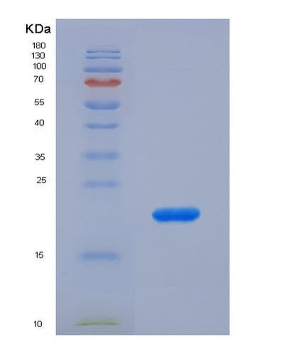 SDS-PAGE analysis of Human DTYMK (Thymidylate Kinase) - Recombinant Protein, CAT# BLT-00895P, showing >90% purity under 15% SDS-PAGE (Reduced)Human DTYMK (Thymidylate Kinase) - Recombinant Protein