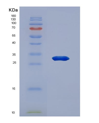 SDS-PAGE analysis of Human EEF1B2 (Elongation Factor 1-Beta) - Recombinant Protein, CAT# BLT-00933P, showing >85% purity under 15% SDS-PAGE (Reduced)Human EEF1B2 (Elongation Factor 1-Beta) - Recombinant Protein