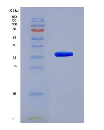 SDS-PAGE analysis of Human ACAT1 (Acetyl-Coa Acetyltransferase, Mitochondrial) - Recombinant Protein, CAT# BLT-00030P, showing >85% purity under 15% SDS-PAGE (Reduced)Human ACAT1 (Acetyl-Coa Acetyltransferase, Mitochondrial) - Recombinant Protein