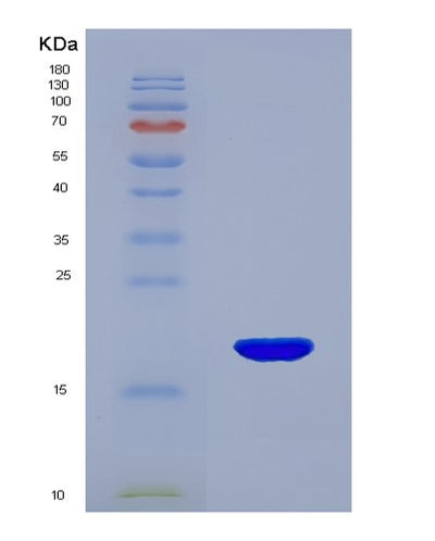SDS-PAGE analysis of Human MYL9 (Myosin Regulatory Light Polypeptide 9) - Recombinant Protein, CAT# BLT-01943P, showing >95% purity under 15% SDS-PAGE (Reduced)Human MYL9 (Myosin Regulatory Light Polypeptide 9) - Recombinant Protein