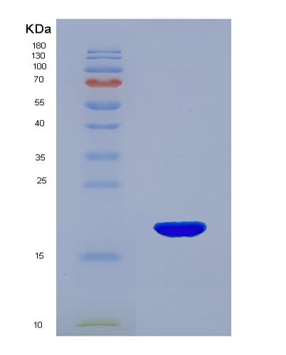 SDS-PAGE analysis of Human MYL9 (Myosin Regulatory Light Polypeptide 9) - Recombinant Protein, CATHuman MYL9 (Myosin Regulatory Light Polypeptide 9) - Recombinant Protein