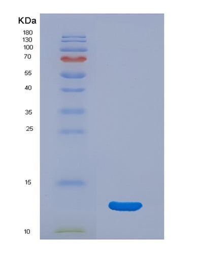 SDS-PAGE analysis of Human CDK2 (Cyclin-Dependent Kinase 2) - Recombinant Protein, CAT# BLT-00541P, showing >95% purity under 15% SDS-PAGE (Reduced)Human CDK2 (Cyclin-Dependent Kinase 2) - Recombinant Protein
