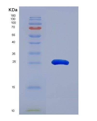 SDS-PAGE analysis of Mouse Tnfrsf1a (Tumor Necrosis Factor Receptor Superfamily Member 1A) - Recombinant Protein, CATMouse Tnfrsf1a (Tumor Necrosis Factor Receptor Superfamily Member 1A) - Recombinant Protein