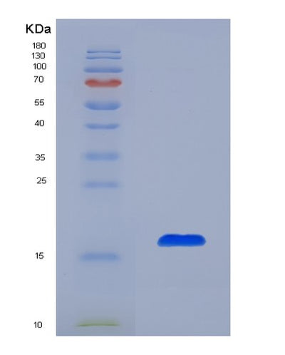 SDS-PAGE analysis of Human AZGP1 (Zinc-Alpha-2-Glycoprotein) - Recombinant Protein, CAT# BLT-00272P, showing >85% purity under 15% SDS-PAGE (Reduced)Human AZGP1 (Zinc-Alpha-2-Glycoprotein) - Recombinant Protein