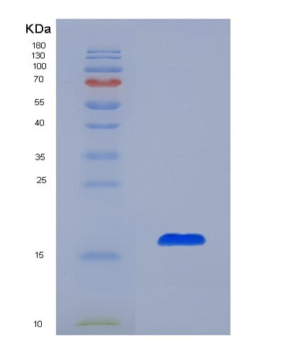 SDS-PAGE analysis of Human AZGP1 (Zinc-Alpha-2-Glycoprotein) - Recombinant Protein, CATHuman AZGP1 (Zinc-Alpha-2-Glycoprotein) - Recombinant Protein