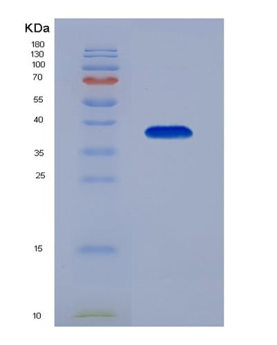 SDS-PAGE analysis of Human DNAJB1 (Dnaj Homolog Subfamily B Member 1) - Recombinant Protein, CAT# BLT-01437P, showing >95% purity under 15% SDS-PAGE (Reduced)Human DNAJB1 (Dnaj Homolog Subfamily B Member 1) - Recombinant Protein