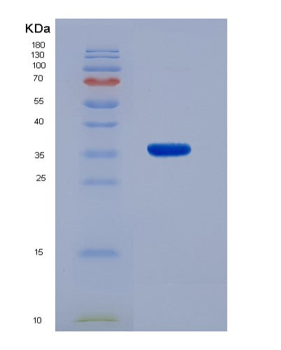 SDS-PAGE analysis of Human DNAJB2 (Dnaj Homolog Subfamily B Member 2) - Recombinant Protein, CATHuman DNAJB2 (Dnaj Homolog Subfamily B Member 2) - Recombinant Protein