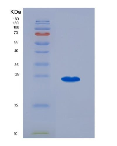 SDS-PAGE analysis of Human PAPPA (Pappalysin-1) - Recombinant Protein, CAT# BLT-07588P, showing >90% purity under 15% SDS-PAGE (Reduced)Human PAPPA (Pappalysin-1) - Recombinant Protein