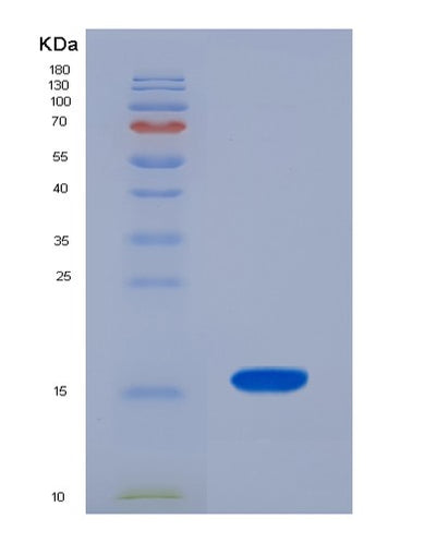 SDS-PAGE analysis of Human MT3 (Metallothionein-3) - Recombinant Protein, CAT# BLT-01917P, showing >90% purity under 15% SDS-PAGE (Reduced)Human MT3 (Metallothionein-3) - Recombinant Protein
