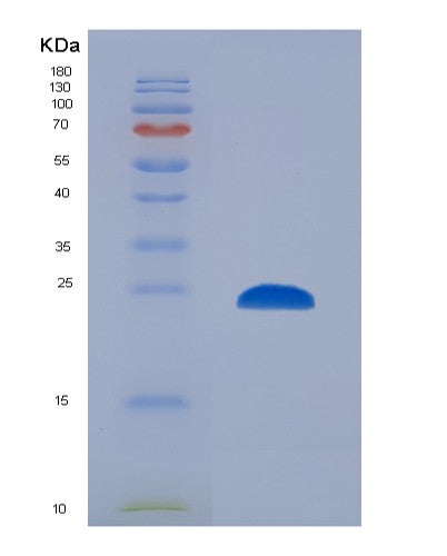 SDS-PAGE analysis of Human CTSS (Cathepsin S) - Recombinant Protein, CATHuman CTSS (Cathepsin S) - Recombinant Protein