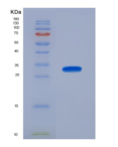 SDS-PAGE analysis of Human PSMA1 (Proteasome Subunit Alpha Type-1) - Recombinant Protein, CAT# BLT-02407P, showing >90% purity under 15% SDS-PAGE (Reduced)Human PSMA1 (Proteasome Subunit Alpha Type-1) - Recombinant Protein