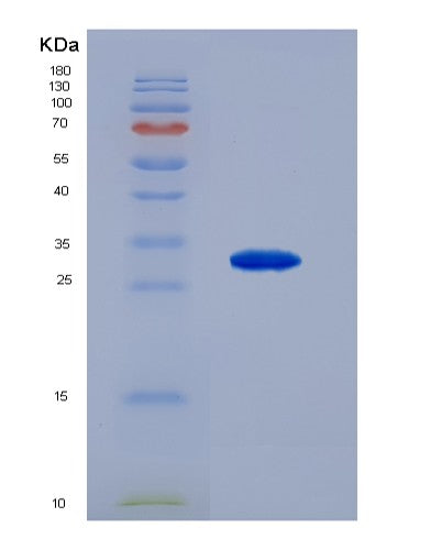 SDS-PAGE analysis of Human CTNNA1 (Catenin Alpha-1) - Recombinant Protein, CATHuman CTNNA1 (Catenin Alpha-1) - Recombinant Protein