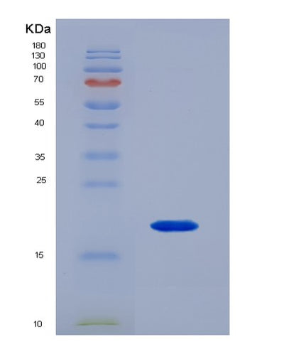SDS-PAGE analysis of Mouse Bmp6 (Bone Morphogenetic Protein 6) - Recombinant Protein, CAT# BLT-07591P, showing >90% purity under 15% SDS-PAGE (Reduced)Mouse Bmp6 (Bone Morphogenetic Protein 6) - Recombinant Protein