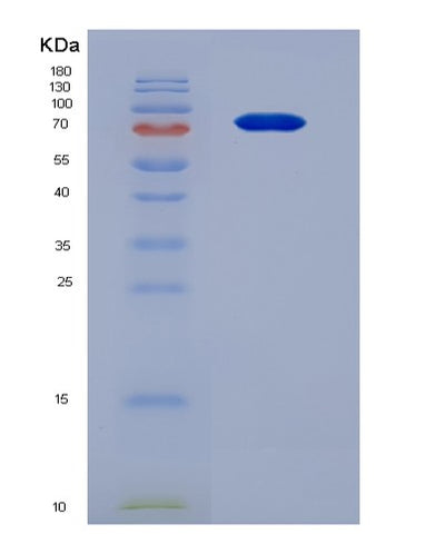 SDS-PAGE analysis of Human MMP9 (Matrix Metalloproteinase-9) - Recombinant Protein, CAT# BLT-07592P, showing >95% purity under 15% SDS-PAGE (Reduced)Human MMP9 (Matrix Metalloproteinase-9) - Recombinant Protein