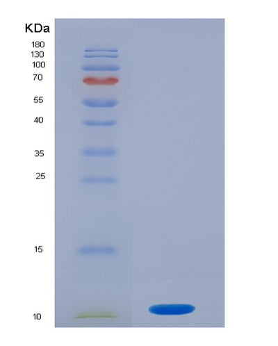 SDS-PAGE analysis of Human S100P (Protein S100-P) - Recombinant Protein, CAT# BLT-02687P, showing >95% purity under 15% SDS-PAGE (Reduced)Human S100P (Protein S100-P) - Recombinant Protein