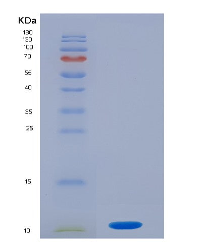 SDS-PAGE analysis of Human S100P (Protein S100-P) - Recombinant Protein, CATHuman S100P (Protein S100-P) - Recombinant Protein