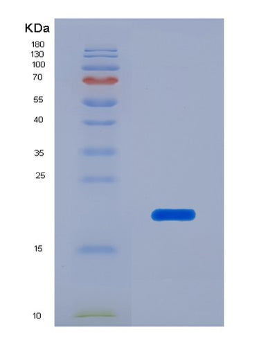 SDS-PAGE analysis of Human NFKBIA (Nf-Kappa-B Inhibitor Alpha) - Recombinant Protein, CAT# BLT-02019P, showing >95% purity under 15% SDS-PAGE (Reduced)Human NFKBIA (Nf-Kappa-B Inhibitor Alpha) - Recombinant Protein