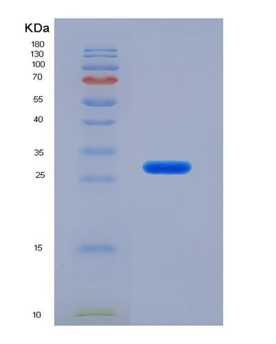 SDS-PAGE analysis of Human IVD (Isovaleryl-Coa Dehydrogenase, Mitochondrial) - Recombinant Protein, CAT# BLT-01599P, showing >90% purity under 15% SDS-PAGE (Reduced)Human IVD (Isovaleryl-Coa Dehydrogenase, Mitochondrial) - Recombinant Protein