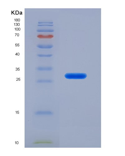 SDS-PAGE analysis of Human IVD (Isovaleryl-Coa Dehydrogenase, Mitochondrial) - Recombinant Protein, CATHuman IVD (Isovaleryl-Coa Dehydrogenase, Mitochondrial) - Recombinant Protein