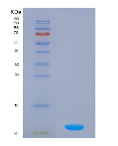 SDS-PAGE analysis of Human S100A4 (Protein S100-A4) - Recombinant Protein, CAT# BLT-02671P, showing >85% purity under 15% SDS-PAGE (Reduced)Human S100A4 (Protein S100-A4) - Recombinant Protein