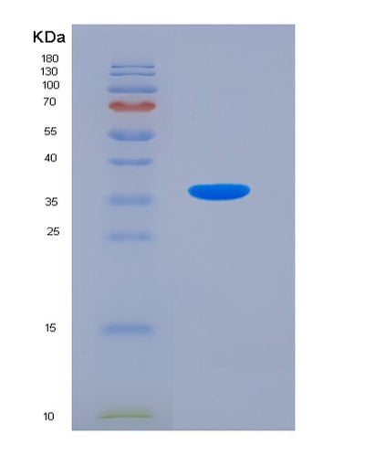 SDS-PAGE analysis of Human CASR (Extracellular Calcium-Sensing Receptor) - Recombinant Protein, CAT# BLT-07593P, showing >90% purity under 15% SDS-PAGE (Reduced)Human CASR (Extracellular Calcium-Sensing Receptor) - Recombinant Protein