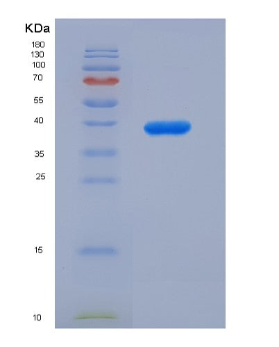 SDS-PAGE analysis of Human TARS1 (Threonine--Trna Ligase 1, Cytoplasmic) - Recombinant Protein, CATHuman TARS1 (Threonine--Trna Ligase 1, Cytoplasmic) - Recombinant Protein