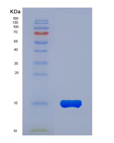 SDS-PAGE analysis of Human KLRK1 (Nkg2-D Type Ii Integral Membrane Protein) - Recombinant Protein, CAT# BLT-01656P, showing >90% purity under 15% SDS-PAGE (Reduced)Human KLRK1 (Nkg2-D Type Ii Integral Membrane Protein) - Recombinant Protein