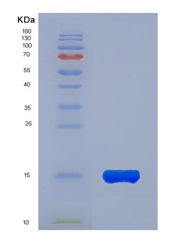 SDS-PAGE analysis of Human KLRK1 (Nkg2-D Type Ii Integral Membrane Protein) - Recombinant Protein, CATHuman KLRK1 (Nkg2-D Type Ii Integral Membrane Protein) - Recombinant Protein