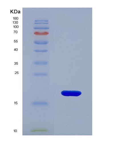 SDS-PAGE analysis of Human FKBP2 (Peptidyl-Prolyl Cis-Trans Isomerase Fkbp2) - Recombinant Protein, CAT# BLT-01094P, showing >85% purity under 15% SDS-PAGE (Reduced)Human FKBP2 (Peptidyl-Prolyl Cis-Trans Isomerase Fkbp2) - Recombinant Protein