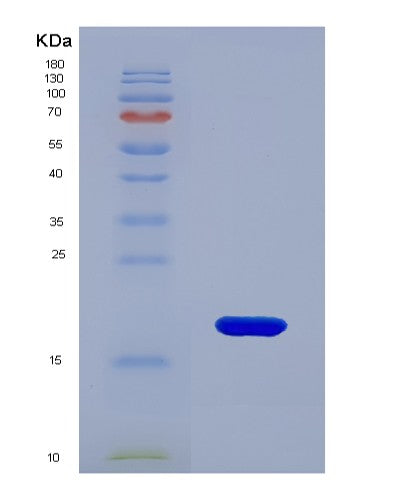 SDS-PAGE analysis of Human FKBP2 (Peptidyl-Prolyl Cis-Trans Isomerase Fkbp2) - Recombinant Protein, CATHuman FKBP2 (Peptidyl-Prolyl Cis-Trans Isomerase Fkbp2) - Recombinant Protein