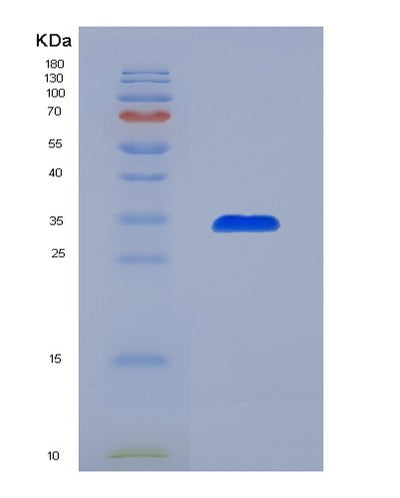 SDS-PAGE analysis of Human CCL7 (C-C Motif Chemokine 7) - Recombinant Protein, CAT# BLT-07596P, showing >90% purity under 15% SDS-PAGE (Reduced)Human CCL7 (C-C Motif Chemokine 7) - Recombinant Protein