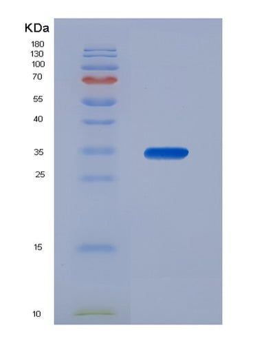 SDS-PAGE analysis of Human ANXA13 (Annexin A13) - Recombinant Protein, CAT# BLT-00173P, showing >95% purity under 15% SDS-PAGE (Reduced)Human ANXA13 (Annexin A13) - Recombinant Protein