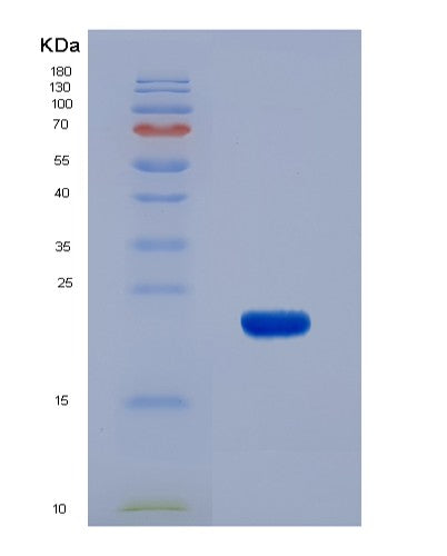 SDS-PAGE analysis of Human CALML3 (Calmodulin-Like Protein 3) - Recombinant Protein, CATHuman CALML3 (Calmodulin-Like Protein 3) - Recombinant Protein