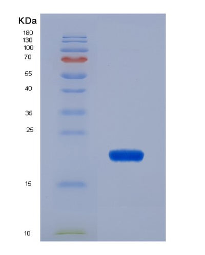 SDS-PAGE analysis of Human CALR (Calreticulin) - Recombinant Protein, CAT# BLT-07598P, showing >90% purity under 15% SDS-PAGE (Reduced)Human CALR (Calreticulin) - Recombinant Protein