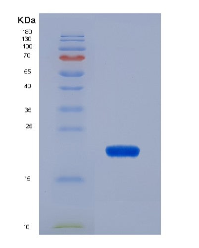 SDS-PAGE analysis of Human CALR (Calreticulin) - Recombinant Protein, CATHuman CALR (Calreticulin) - Recombinant Protein