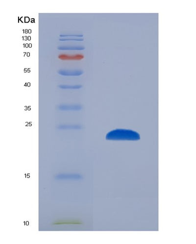 SDS-PAGE analysis of Human PSMB8 (Proteasome Subunit Beta Type-8) - Recombinant Protein, CAT# BLT-02423P, showing >85% purity under 15% SDS-PAGE (Reduced)Human PSMB8 (Proteasome Subunit Beta Type-8) - Recombinant Protein