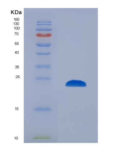 SDS-PAGE analysis of Human PSMB8 (Proteasome Subunit Beta Type-8) - Recombinant Protein, CATHuman PSMB8 (Proteasome Subunit Beta Type-8) - Recombinant Protein
