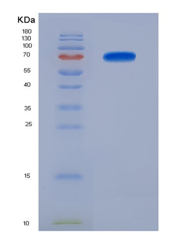 SDS-PAGE analysis of Human PREP (Prolyl Endopeptidase) - Recombinant Protein, CAT# BLT-07599P, showing >90% purity under 15% SDS-PAGE (Reduced)Human PREP (Prolyl Endopeptidase) - Recombinant Protein