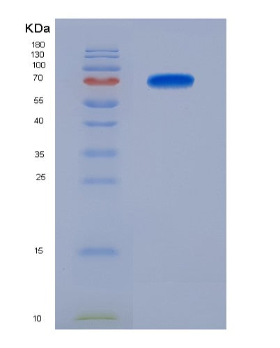 SDS-PAGE analysis of Human PREP (Prolyl Endopeptidase) - Recombinant Protein, CATHuman PREP (Prolyl Endopeptidase) - Recombinant Protein