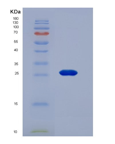 SDS-PAGE analysis of Human GSTM2 (Glutathione S-Transferase Mu 2) - Recombinant Protein, CATHuman GSTM2 (Glutathione S-Transferase Mu 2) - Recombinant Protein