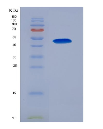 SDS-PAGE analysis of Human LOX (Protein-Lysine 6-Oxidase) - Recombinant Protein, CAT# BLT-01733P, showing >85% purity under 15% SDS-PAGE (Reduced)Human LOX (Protein-Lysine 6-Oxidase) - Recombinant Protein