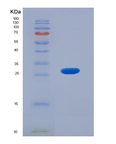 SDS-PAGE analysis of Human ACADL (Long-Chain Specific Acyl-Coa Dehydrogenase, Mitochondrial) - Recombinant Protein, CAT# BLT-00025P, showing >95% purity under 15% SDS-PAGE (Reduced)Human ACADL (Long-Chain Specific Acyl-Coa Dehydrogenase, Mitochondrial) - Recombinant Protein