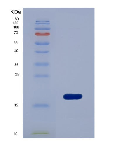 SDS-PAGE analysis of Human GCA (Grancalcin) - Recombinant Protein, CAT# BLT-01164P, showing >90% purity under 15% SDS-PAGE (Reduced)Human GCA (Grancalcin) - Recombinant Protein
