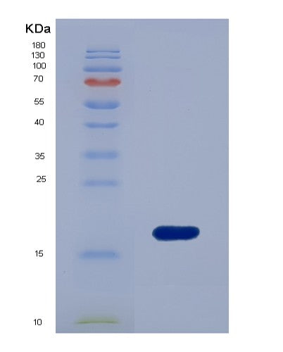 SDS-PAGE analysis of Human GCA (Grancalcin) - Recombinant Protein, CATHuman GCA (Grancalcin) - Recombinant Protein