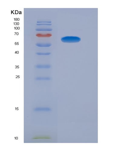 SDS-PAGE analysis of Human PTPN4 (Tyrosine-Protein Phosphatase Non-Receptor Type 4) - Recombinant Protein, CAT# BLT-02446P, showing >90% purity under 15% SDS-PAGE (Reduced)Human PTPN4 (Tyrosine-Protein Phosphatase Non-Receptor Type 4) - Recombinant Protein